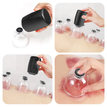 Electric Vacuum Cupping Set